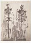 Skeleton of Man and of the Male Gorilla (Troglodytes Gorilla) thumbnail 2