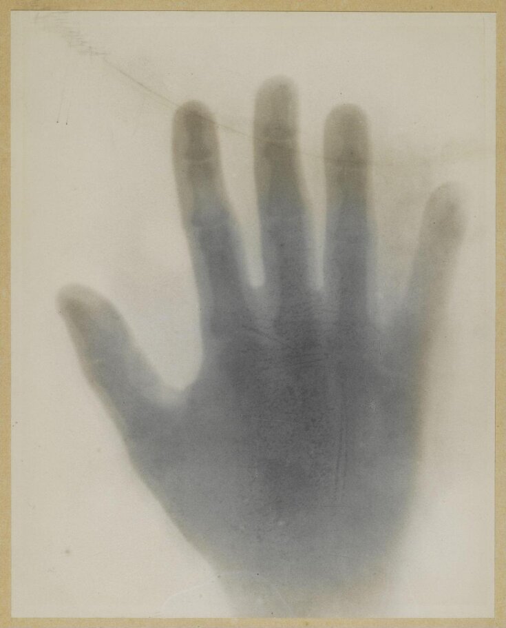 Print from the first X-ray negative of the human hand top image
