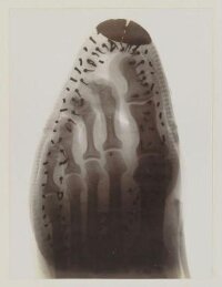 Album of X-Ray Photographs