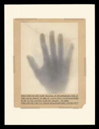 Print from the first X-ray negative of the human hand