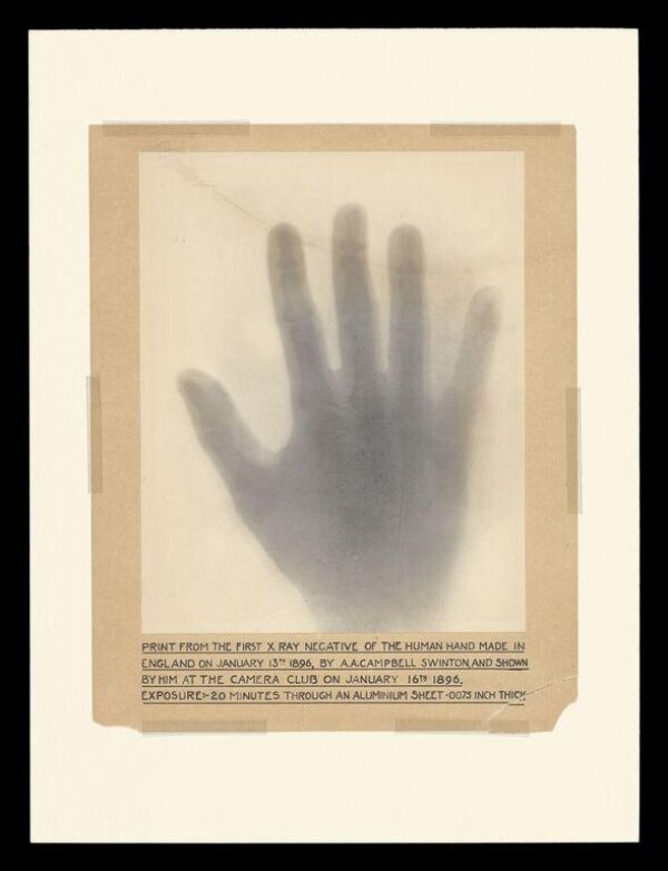 Print from the first X-ray negative of the human hand